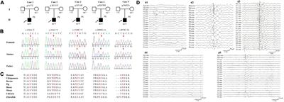 AFF2 Is Associated With X-Linked Partial (Focal) Epilepsy With Antecedent Febrile Seizures